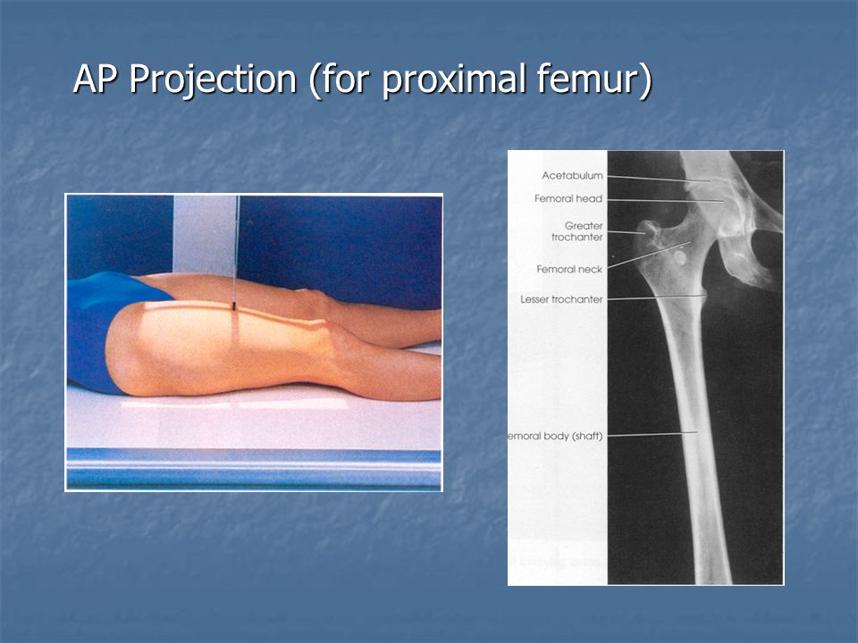 Radiographic Positioning Of The Femur And Tib Fib Ce Rt